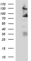 CD44 Antibody - HEK293T cells were transfected with the pCMV6-ENTRY control (Left lane) or pCMV6-ENTRY CD44 (Right lane) cDNA for 48 hrs and lysed. Equivalent amounts of cell lysates (5 ug per lane) were separated by SDS-PAGE and immunoblotted with anti-CD44.