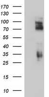 CD44 Antibody - HEK293T cells were transfected with the pCMV6-ENTRY control (Left lane) or pCMV6-ENTRY CD44 (Right lane) cDNA for 48 hrs and lysed. Equivalent amounts of cell lysates (5 ug per lane) were separated by SDS-PAGE and immunoblotted with anti-CD44.