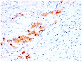 CD44 Antibody - Formalin-fixed, paraffin-embedded human Bladder stained with CD44v4 Mouse Recombinant Monoclonal Antibody (rCD44v4/1219).