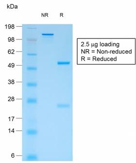 CD44 Antibody - SDS-PAGE Analysis Purified CD44v4 Mouse Recombinant Monoclonal Antibody (rCD44v4/1219). Confirmation of Purity and Integrity of Antibody.