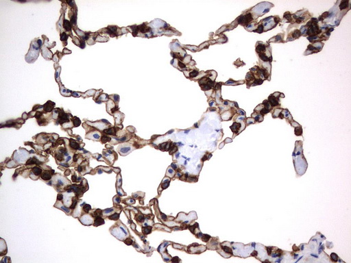 CD44 Antibody - Immunohistochemical staining of paraffin-embedded Human lung tissue using anti-CD44 mouse monoclonal antibody.  heat-induced epitope retrieval by 10mM citric buffer, pH6.0, 120C for 3min)