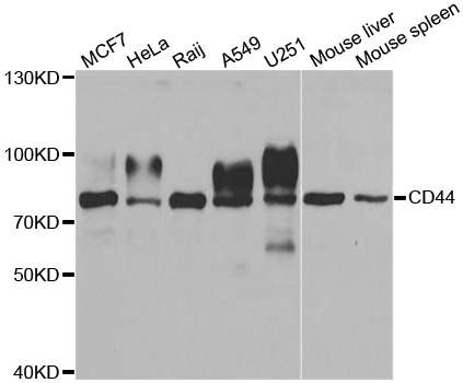 CD44 Antibody - Western blot analysis of extracts of various cell lines, using CD44 antibody at 1:1000 dilution. The secondary antibody used was an HRP Goat Anti-Rabbit IgG (H+L) at 1:10000 dilution. Lysates were loaded 25ug per lane and 3% nonfat dry milk in TBST was used for blocking.