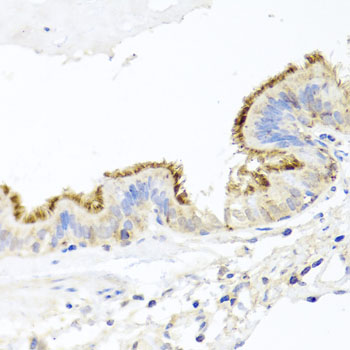 CD44 Antibody - Immunohistochemistry of paraffin-embedded human trachea using CD44 antibody at dilution of 1:100 (40x lens).