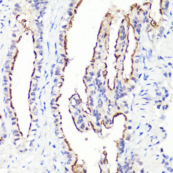 CD44 Antibody - Immunohistochemistry of paraffin-embedded rat lung using CD44 antibody at dilution of 1:100 (40x lens).