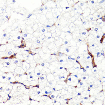 CD44 Antibody - Immunohistochemistry of paraffin-embedded human liver using CD44 antibody at dilution of 1:100 (40x lens).