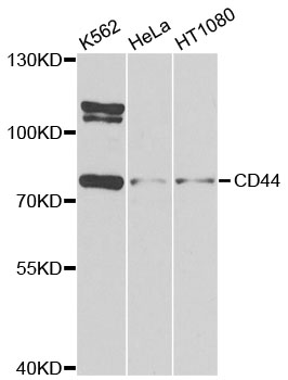 CD44 Antibody - Western blot analysis of extracts of various cell lines, using CD44 antibody at 1:1000 dilution. The secondary antibody used was an HRP Goat Anti-Rabbit IgG (H+L) at 1:10000 dilution. Lysates were loaded 25ug per lane and 3% nonfat dry milk in TBST was used for blocking. An ECL Kit was used for detection and the exposure time was 90s.