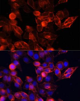 CD44 Antibody - Immunofluorescence analysis of HeLa cells using CD44 antibody at dilution of 1:100. Blue: DAPI for nuclear staining.