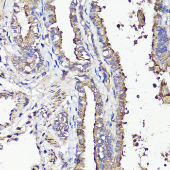 CD44 Antibody - Immunohistochemistry of paraffin-embedded rat bronchus using CD44 antibody at dilution of 1:100 (40x lens).
