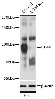 CD44 Antibody - Western blot analysis of extracts from normal (control) and CD44 knockout (KO) HeLa cells, using CD44 antibody at 1:1000 dilution. The secondary antibody used was an HRP Goat Anti-Rabbit IgG (H+L) at 1:10000 dilution. Lysates were loaded 25ug per lane and 3% nonfat dry milk in TBST was used for blocking. An ECL Kit was used for detection and the exposure time was 5s.