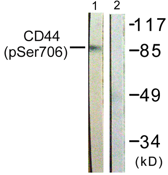 CD44 Antibody - Western blot analysis of lysates from NIH/3T3 cells treated with PMA 250ng/ml 5', using CD44 (Phospho-Ser706) Antibody. The lane on the right is blocked with the phospho peptide.