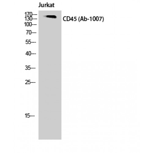 CD45 / LCA Antibody - Western blot of CD45 antibody