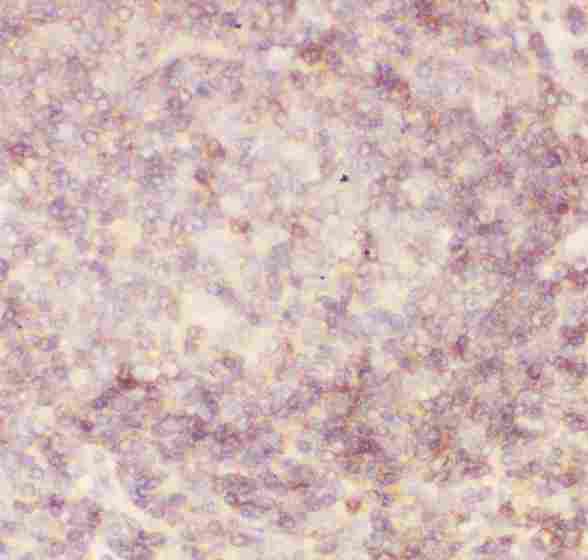 CD45 / LCA Antibody - Anti-CD45 Picoband antibody, IHC(P): Human Tonsil Tissue
