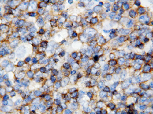 CD45 / LCA Antibody - CD45 antibody. IHC(P): Human Tonsil Tissue.