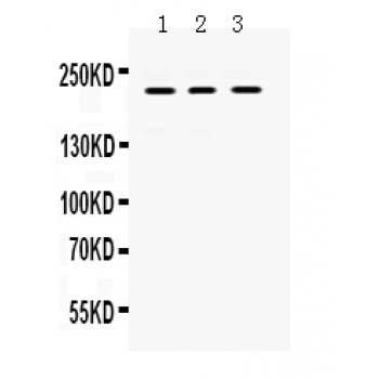 CD45 / LCA Antibody - CD45 antibody Western blot. All lanes: Anti CD45 at 0.5 ug/ml. Lane 1: JURKAT Whole Cell Lysate at 40 ug. Lane 2: HL-60 Whole Cell Lysate at 40 ug. Lane 3: K562 Whole Cell Lysate at 40 ug. Predicted band size: 220 kD. Observed band size: 220 kD.