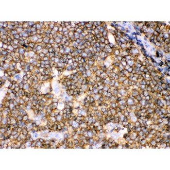 CD45 / LCA Antibody - CD45 antibody IHC-paraffin. IHC(P): Human Tonsil Tissue.