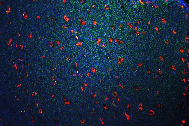 CD45 / LCA Antibody - IF analysis of CD68/CD45 using anti-CD68/CD45 antibody. CD68/CD45 was detected in paraffin-embedded section of human tonsil tissues. Heat mediated antigen retrieval was performed in citrate buffer (pH6, epitope retrieval solution ) for 20 mins. The tissue section was blocked with 10% goat serum. The tissue section was then incubated with 1µg/mL mouse anti-CD68 Antibody/rabbit anti CD45 Antibody overnight at 4°C. Cy3 conjugated Avidinand DyLight®488 Conjugated Goat Anti-Rabbit IgG was used as secondary antibody at 1:100 dilution and incubated for 30 minutes at 37°C. The section was counterstained with DAPI. Visualize using a fluorescence microscope and filter sets appropriate for the label used.