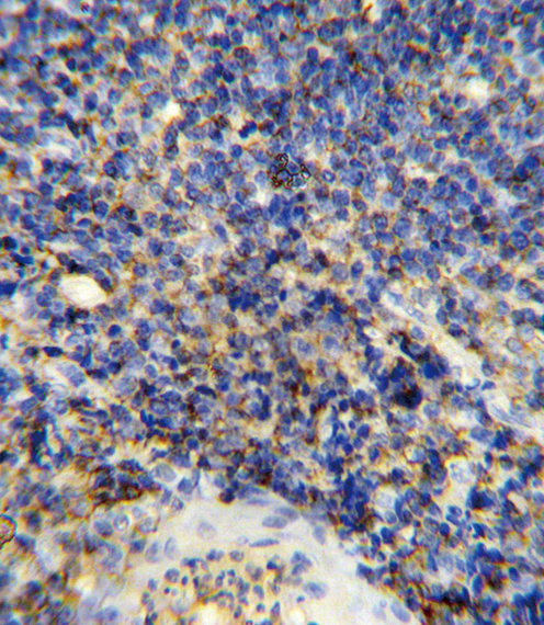 CD45 / LCA Antibody - Formalin-fixed and paraffin-embedded human tonsil reacted with CD45 Antibody , which was peroxidase-conjugated to the secondary antibody, followed by DAB staining. This data demonstrates the use of this antibody for immunohistochemistry; clinical relevance has not been evaluated.