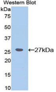 CD45 / LCA Antibody - Western blot of recombinant CD45.  This image was taken for the unconjugated form of this product. Other forms have not been tested.