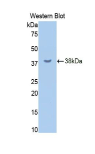 CD45 / LCA Antibody - Western blot of recombinant CD45.  This image was taken for the unconjugated form of this product. Other forms have not been tested.
