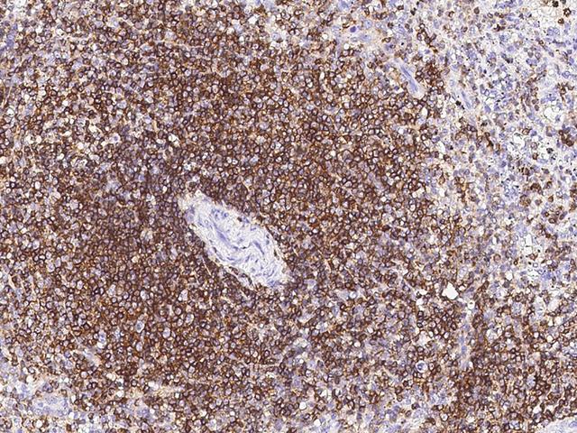 CD45 / LCA Antibody - Immunochemical staining of human LCA in human spleen with rabbit monoclonal antibody at 1:200 dilution, formalin-fixed paraffin embedded sections.