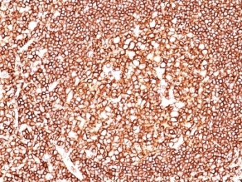 CD45 / LCA Antibody - IHC testing of human tonsil with CD45 antibody.  This image was taken for the unmodified form of this product. Other forms have not been tested.