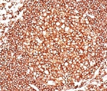 CD45 / LCA Antibody - IHC: human tonsil stained with CD45 antibody.  This image was taken for the unmodified form of this product. Other forms have not been tested.