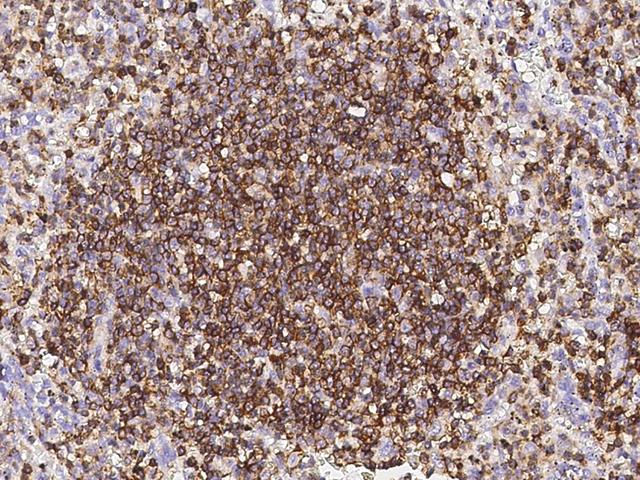 CD45 / LCA Antibody - Immunochemical staining of human LCA in human spleen with rabbit monoclonal antibody at 1:200 dilution, formalin-fixed paraffin embedded sections.