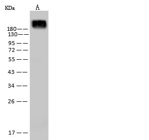 CD45 / LCA Antibody - Anti-PTPRC mouse monoclonal antibody at 1:500 dilution. Lane A: Jurkat Whole Cell Lysate. Lane B: Daudi Whole Cell Lysate. Lysates/proteins at 30 ug per lane. Secondary: Goat Anti-Mouse IgG (H+L)/HRP at 1/10000 dilution. Developed using the ECL technique. Performed under reducing conditions. Predicted band size: 147 kDa.
