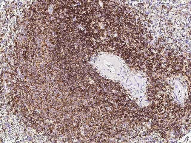 CD45 / LCA Antibody - Immunochemical staining of human PTPRC in human spleen with mouse monoclonal antibody at 1:5000 dilution, formalin-fixed paraffin embedded sections.