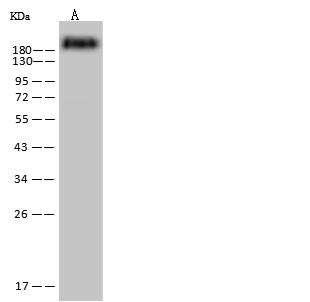 CD45 / LCA Antibody - Anti-PTPRC mouse monoclonal antibody at 1:500 dilution. Lane A: Jurkat Whole Cell Lysate. Lysates/proteins at 30 ug per lane. Secondary: Goat Anti-Mouse IgG (H+L)/HRP at 1/10000 dilution. Developed using the ECL technique. Performed under reducing conditions. Predicted band size: 143 kDa.