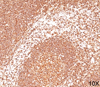 CD45 / LCA Antibody - CD45 antibody 2B11 immunohistochemistry spleen 10X This image was taken for the unmodified form of this product. Other forms have not been tested.