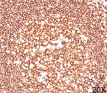 CD45 / LCA Antibody - CD45 antibody 2B11 immunohistochemistry spleen 20X This image was taken for the unmodified form of this product. Other forms have not been tested.
