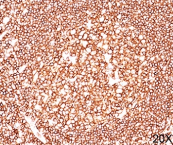 CD45 / LCA Antibody - CD45 antibody 2B11 + PD7/26 immunohistochemistry tonsil 20X This image was taken for the unmodified form of this product. Other forms have not been tested.