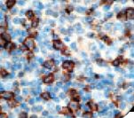 CD45 / LCA Antibody - IHC of CD45 on FFPE Tonsil tissue.