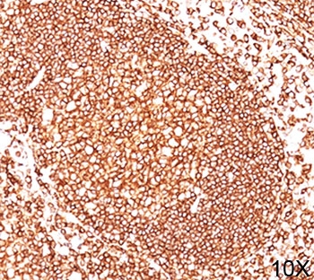 CD45 / LCA Antibody - CD45 antibody 2B11 + PD7/26 immunohistochemistry tonsil 10X