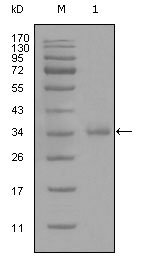 CD45 / LCA Antibody - Western blot using anti-CD45 monoclonal antibody against truncated CD45 recombinant protein (1).