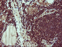 CD45 / LCA Antibody - IHC of paraffin-embedded Human thyroid tissue using anti-PTPRC mouse monoclonal antibody.