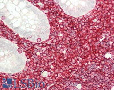 CD45 / LCA Antibody - Human Small Intestine, MALT: Formalin-Fixed, Paraffin-Embedded (FFPE)