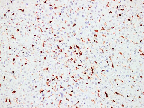 CD45 / LCA Antibody - Liver