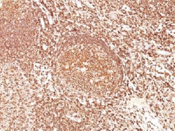 CD45 / LCA Antibody - IHC test of FFPE human tonsil probed with CD45 antibody (clone F10-89-4). Required HIER: boil tissue sections in 10mM citrate buffer, pH 6, for 10-20 min.