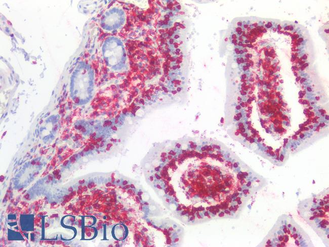 CD45 / LCA Antibody - Human Small Intestine: Formalin-Fixed, Paraffin-Embedded (FFPE)