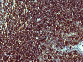 CD45 / LCA Antibody - IHC of paraffin-embedded Human lymph node tissue using anti-PTPRC mouse monoclonal antibody. (Heat-induced epitope retrieval by 10mM citric buffer, pH6.0, 120°C for 3min).