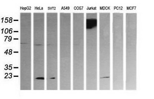 CD45 / LCA Antibody - Western blot of extracts (35 ug) from 9 different cell lines by using anti-PTPRC monoclonal antibody (HepG2: human; HeLa: human; SVT2: mouse; A549: human; COS7: monkey; Jurkat: human; MDCK: canine; PC12: rat; MCF7: human).