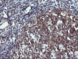 CD45 / LCA Antibody - IHC of paraffin-embedded Human tonsil using anti-PTPRC mouse monoclonal antibody.