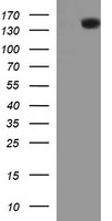 CD45 / LCA Antibody - HEK293T cells were transfected with the pCMV6-ENTRY control (Left lane) or pCMV6-ENTRY PTPRC (Right lane) cDNA for 48 hrs and lysed. Equivalent amounts of cell lysates (5 ug per lane) were separated by SDS-PAGE and immunoblotted with anti-PTPRC.