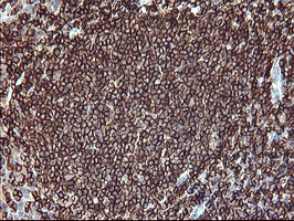 CD45 / LCA Antibody - IHC of paraffin-embedded Human lymph node tissue using anti-PTPRC mouse monoclonal antibody.