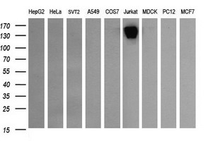 CD45 / LCA Antibody - Western blot of extracts (35 ug) from 9 different cell lines by using anti-PTPRC monoclonal antibody (HepG2: human; HeLa: human; SVT2: mouse; A549: human; COS7: monkey; Jurkat: human; MDCK: canine; PC12: rat; MCF7: human).