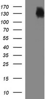 CD45 / LCA Antibody - HEK293T cells were transfected with the pCMV6-ENTRY control (Left lane) or pCMV6-ENTRY PTPRC (Right lane) cDNA for 48 hrs and lysed. Equivalent amounts of cell lysates (5 ug per lane) were separated by SDS-PAGE and immunoblotted with anti-PTPRC.