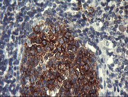 CD45 / LCA Antibody - IHC of paraffin-embedded Human tonsil using anti-PTPRC mouse monoclonal antibody.