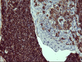 CD45 / LCA Antibody - IHC of paraffin-embedded Human lymph node tissue using anti-PTPRC mouse monoclonal antibody. (heat-induced epitope retrieval by 1 mM EDTA in 10mM Tris, pH8.5, 120°C for 3min).